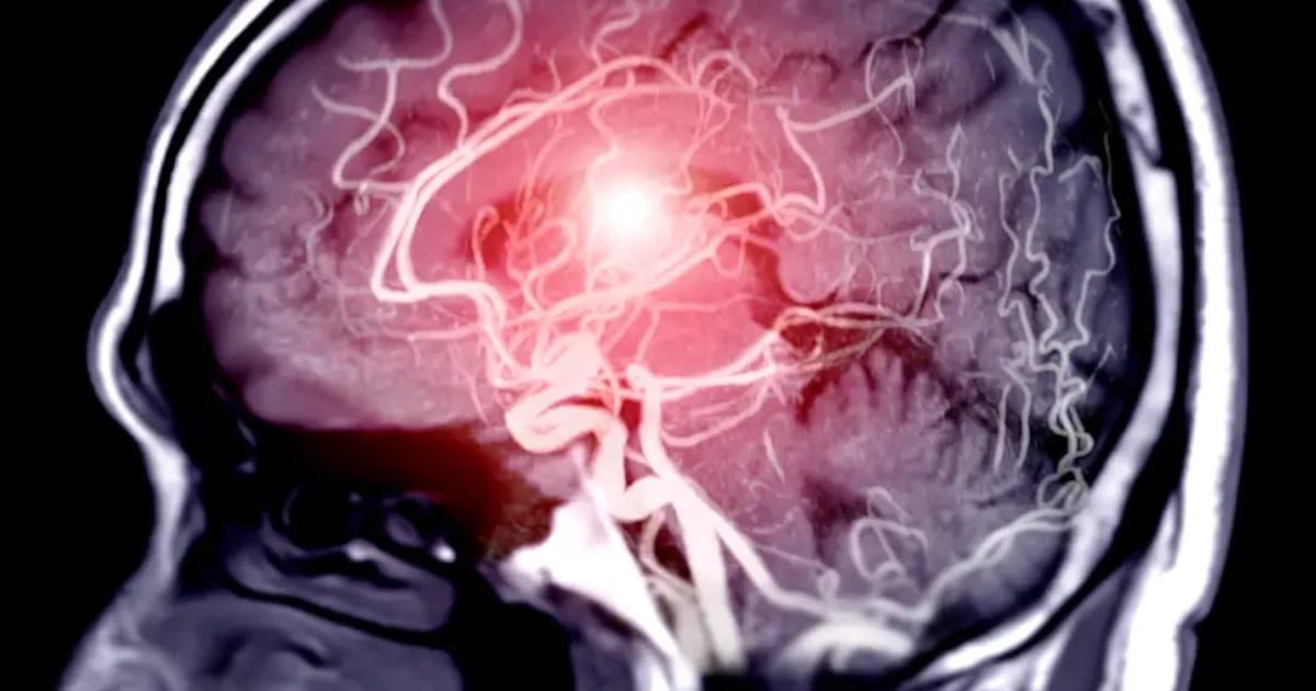 Un estudio detectó un gen que podría mejorar la atención y reducir el “ruido” cerebral en personas con trastornos psicológicos – La 100