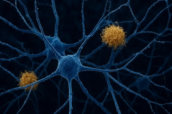 El ensayo clínico US POINTER