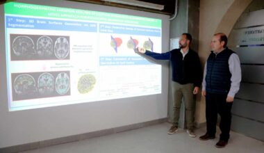 Identifican un biomarcador para la detección del alzhéimer