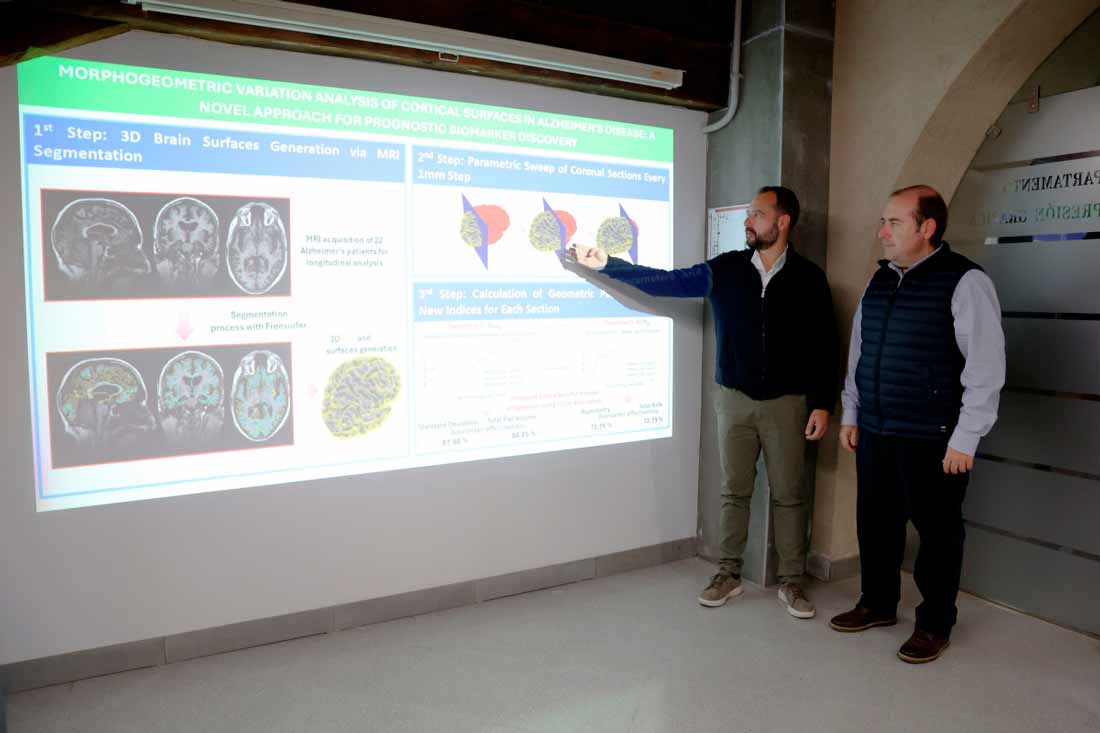 Identifican un biomarcador para la detección del alzhéimer