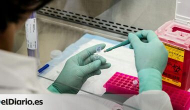 Documentan un caso especial de remisión del VIH tras un trasplante de células madre a un enfermo de cáncer