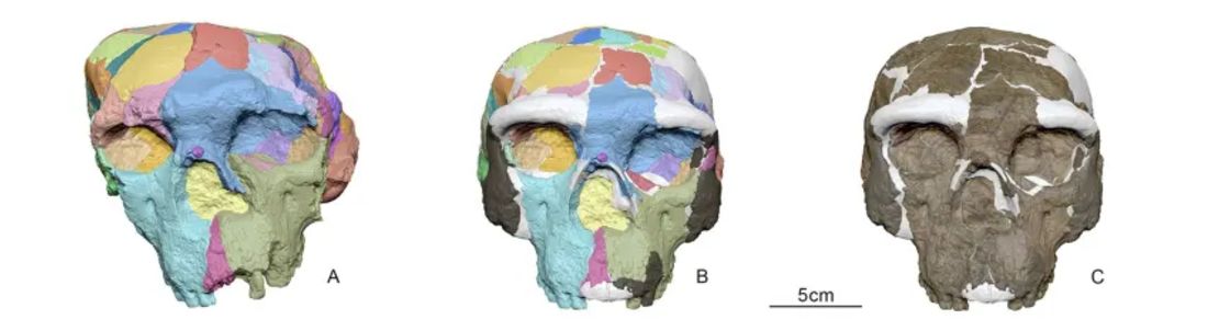 Los científicos utilizaron técnicas digitales para reconstruir un cráneo que estaba gravemente deformado.