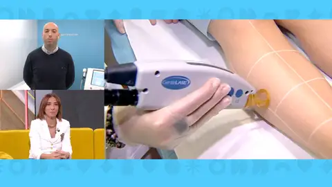 Depilación láser en las cárceles