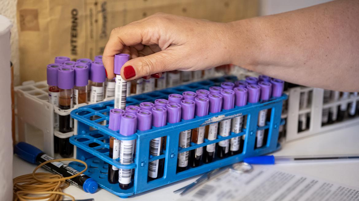 Una mano recoge un tubo de muestra de sangre