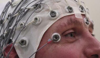 Senoterapia, limpiar el cerebro de células envejecidas para tratar la epilepsia