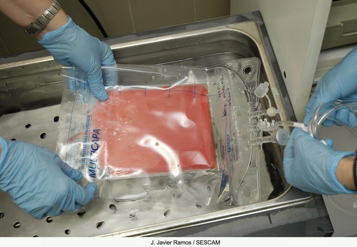 Consiguen eliminar el VIH de un paciente de leucemia con un trasplante de células madre