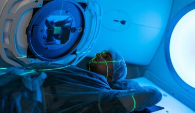 ¿Duele la radioterapia? ¿Te deja radioactivo? El nuevo testimonio experto que desmonta todos los miedos