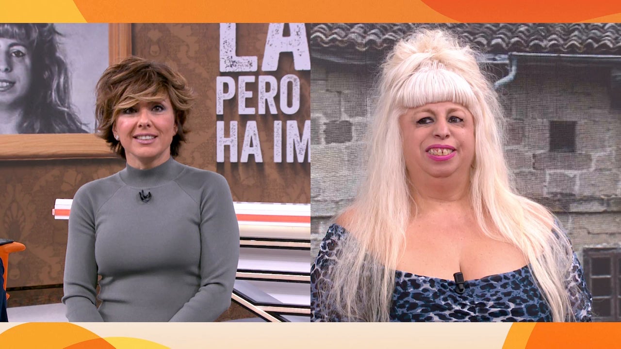 "Nací con el síndrome de Treacher Collins, pero me encanto"