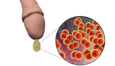 Un nuevo tratamiento oral de dosis &uacute;nica combate eficazmente la gonorrea