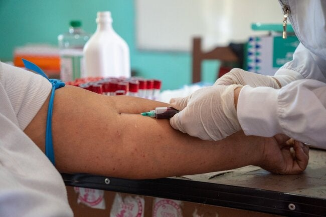 Bolivia refuerza la vigilancia para reducir la letalidad de hantavirus y la leptospirosis en zonas endémicas - OPS/OMS