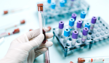 Expertos destacan la inmunoterapia como eje del tratamiento temprano en los cánceres hematológicos