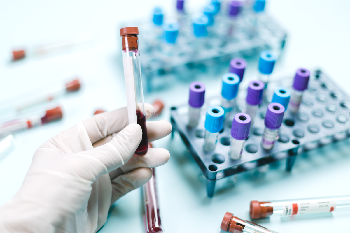 Expertos destacan la inmunoterapia como eje del tratamiento temprano en los cánceres hematológicos