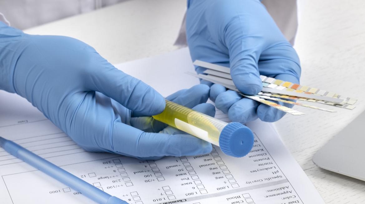 Manos de médico con muestras para analizar