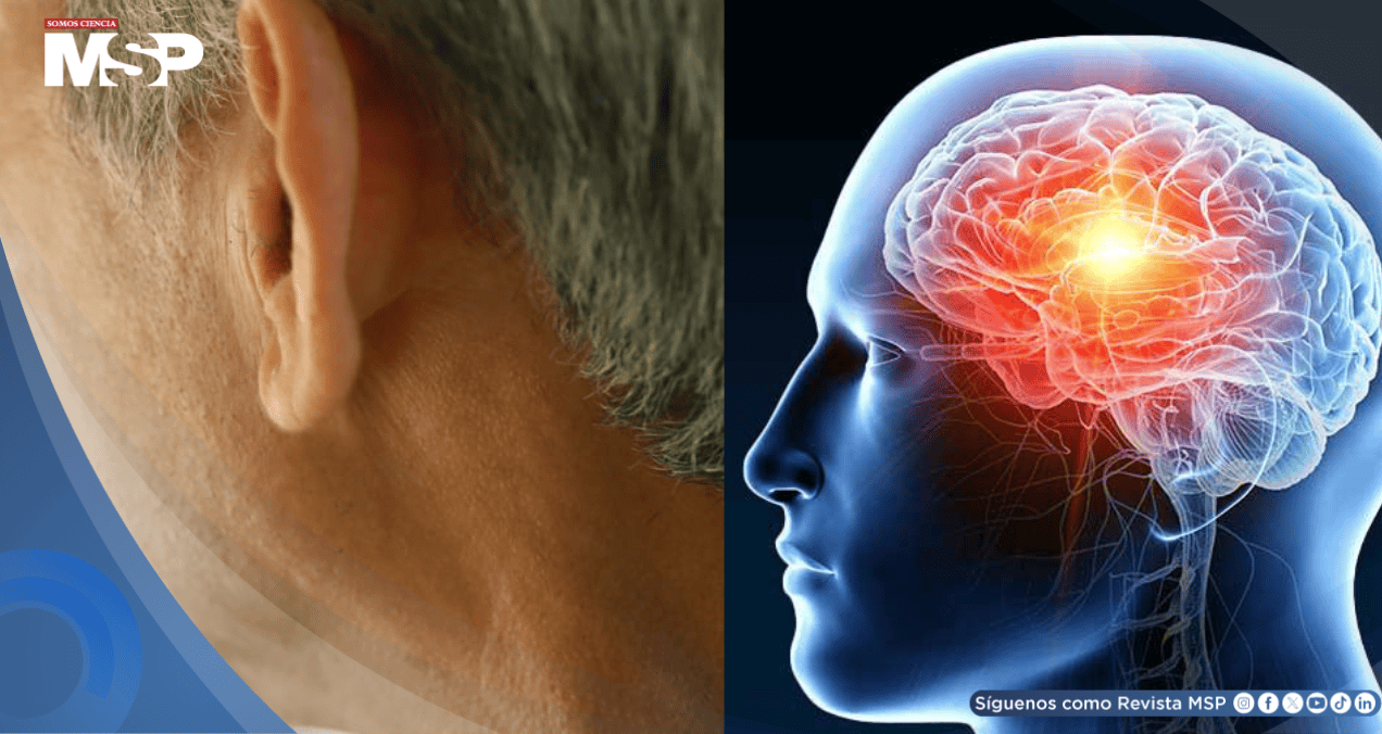 Pérdida auditiva en la mediana edad aumentaría el 71% el riesgo de demencia, según estudio