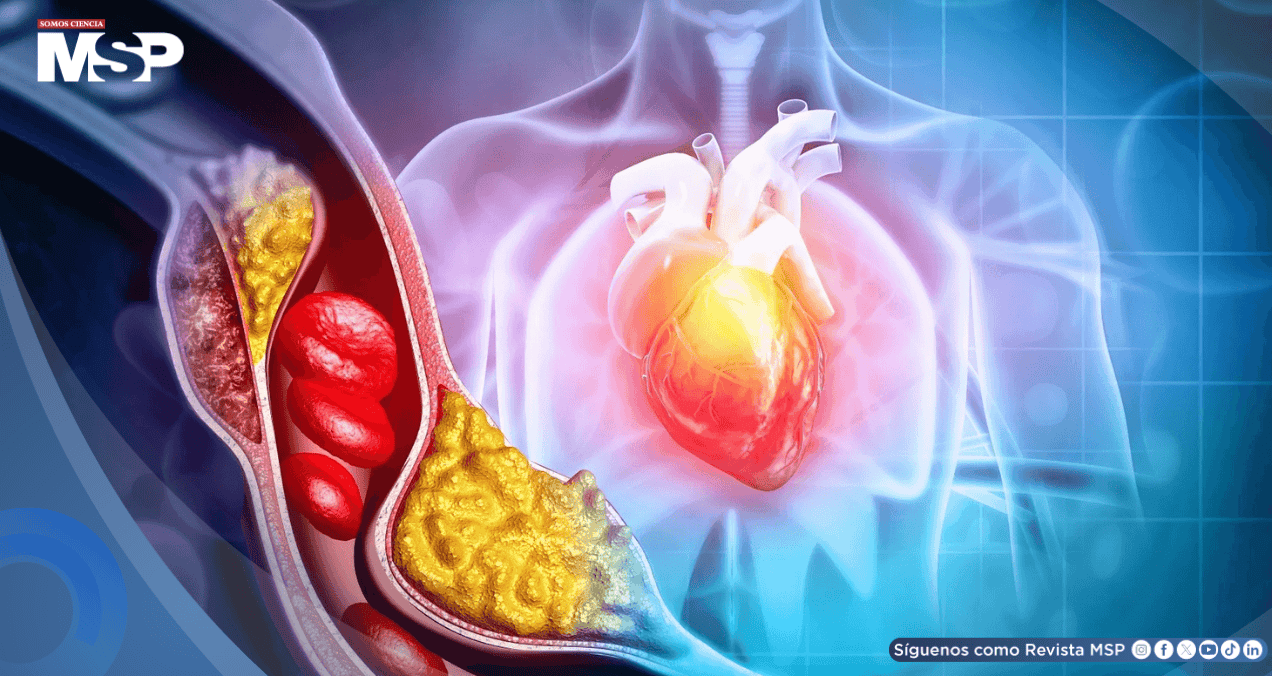 Diabetes podría multiplicar hasta siete veces el riesgo de muerte súbita cardíaca en jóvenes
