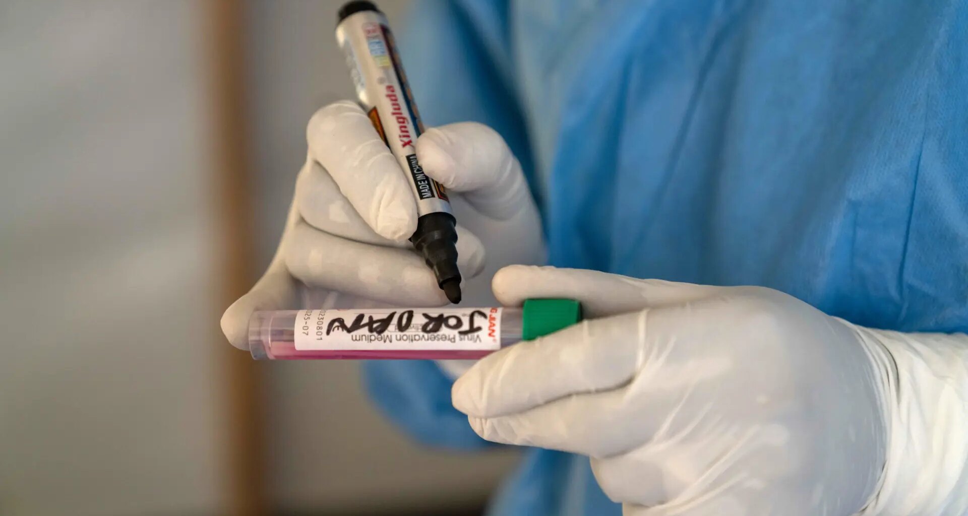 Identifican una nueva cepa de viruela del mono en Inglaterra