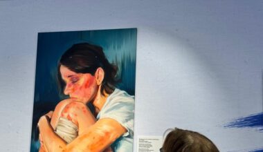 una exposición que muestra la dermatitis atópica grave