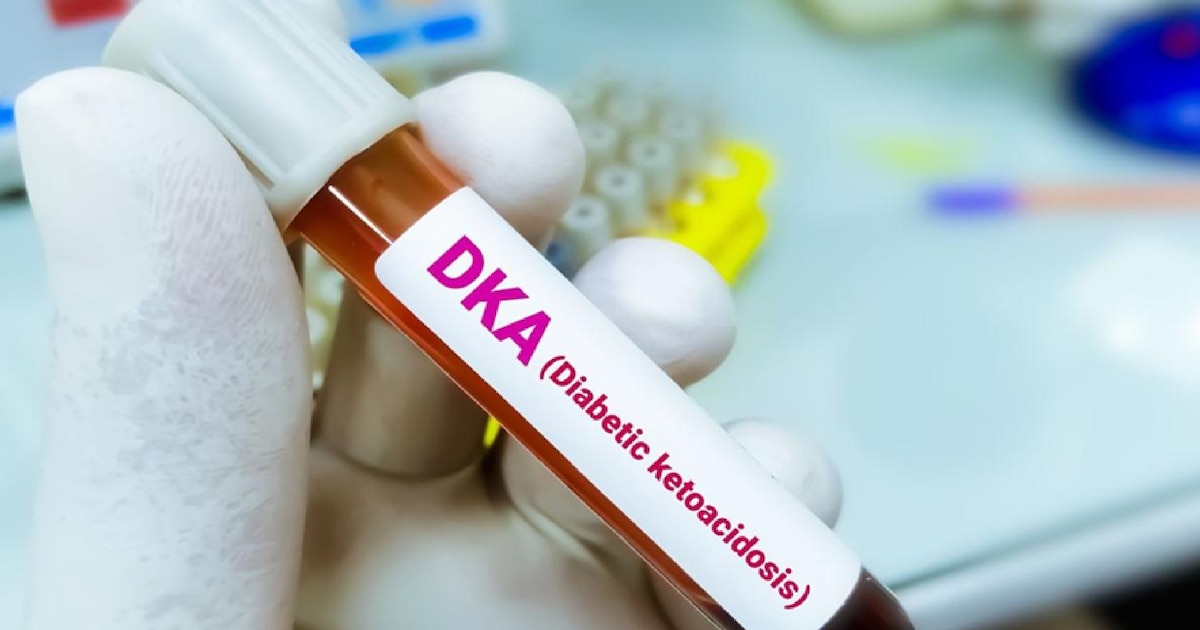 Impulsan campaña nacional para concientizar sobre la cetoacidosis diabética