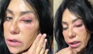 Preocupación por Maite Galdeano tras aparecer así en redes: "No os asustéis"