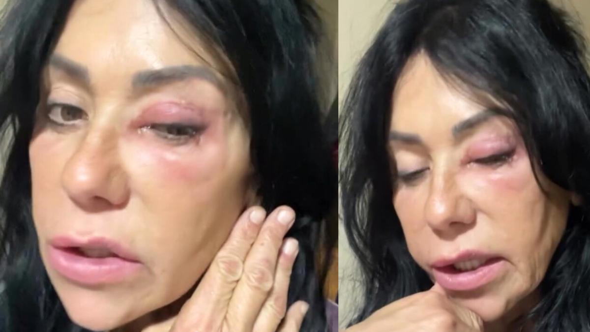 Preocupación por Maite Galdeano tras aparecer así en redes: "No os asustéis"