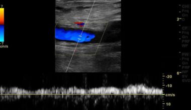 El Periódico Mediterráneo