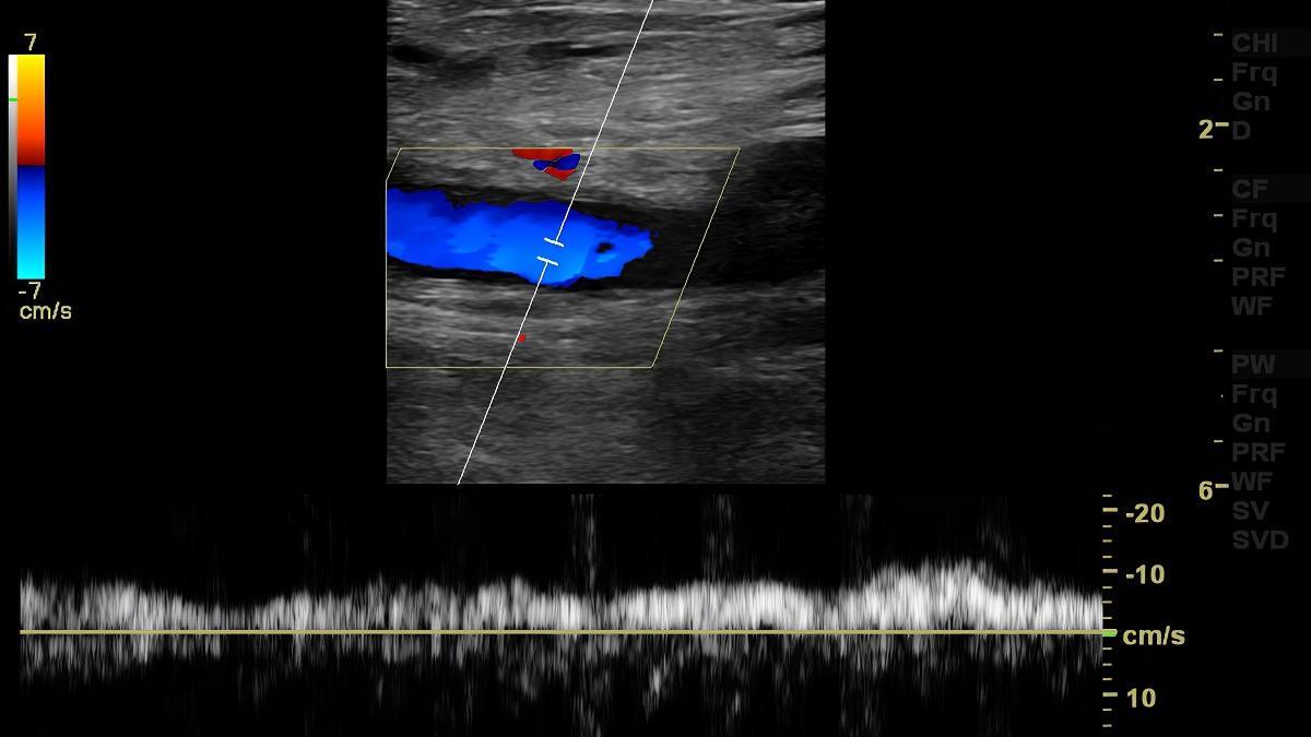 El Periódico Mediterráneo