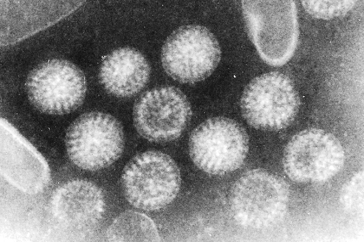 Los rotavirus son la causa más frecuente de gastroenteritis aguda infantil.