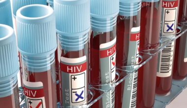 Combinar un fármaco y una vacuna terapéutica contra el VIH potencia las células defensivas