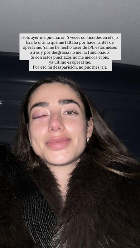 Lola Lolita muestra el estado de su cara.