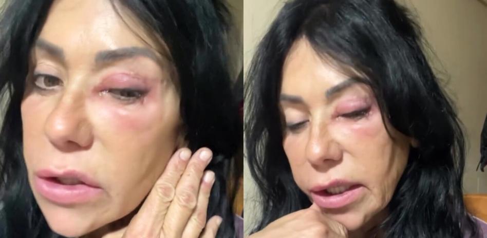 Preocupación por Maite Galdeano tras aparecer así en redes: 