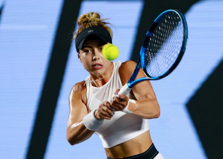 La tenista Renata Zarazúa desnuda su espalda quemada para alertar del peligro del sol en Australia