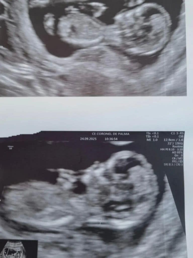 El actor Adam Jezierski está esperando su primer hijo
