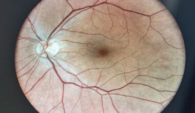 Un fármaco experimental logra proteger la visión en ratones con glaucoma inducido y apunta a futuros ensayos en humanos | Líder en Información Social