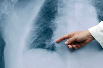 El avance se publica en