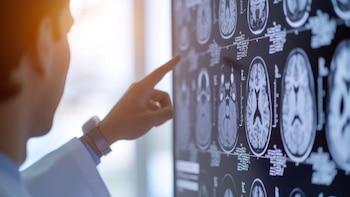 El principal obstáculo para la