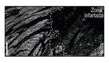 CNIC-estrategia-terapéutica-infarto