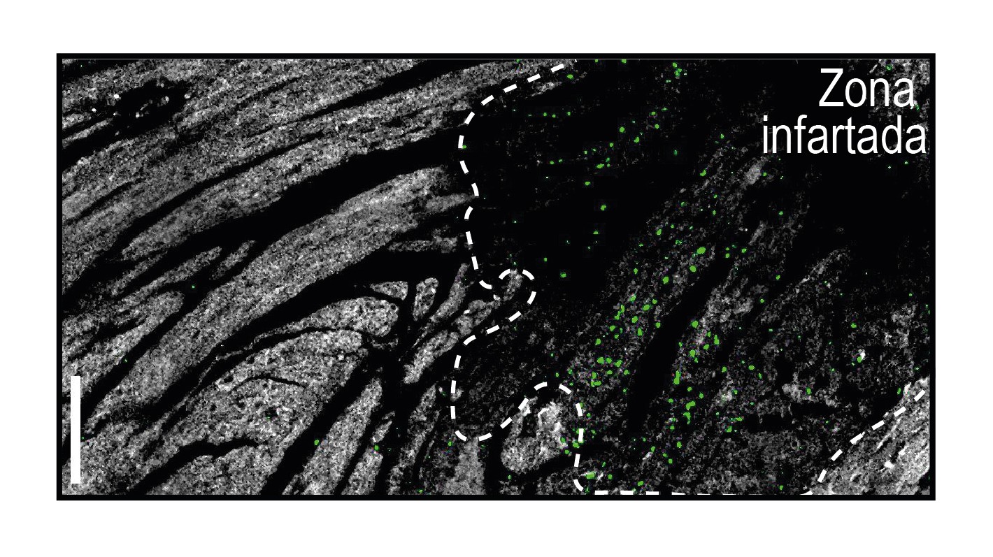 CNIC-estrategia-terapéutica-infarto