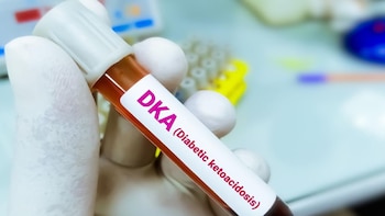 Campaña nacional para concientizar sobre