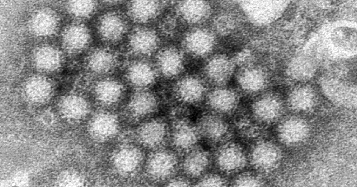 Esto es lo que debe saber