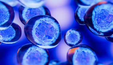 Las biopsias líquidas permiten analizar células tumorales circulantes o ADN tumoral libre en diferentes fluidos, como la orina, en el caso del cáncer de vejiga.