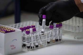 Científicos priorizaron el análisis de