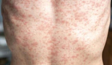 cómo prevenir contagios y proteger a tu familia