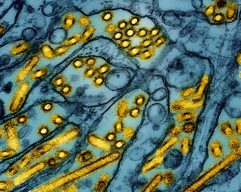 El virus H5N1 encabeza la