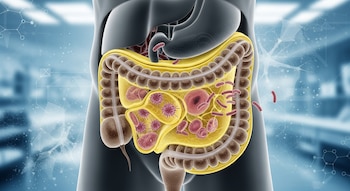 La grasa cercana al colon