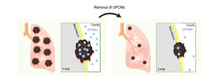 Pleural cavity macrophages infiltrate