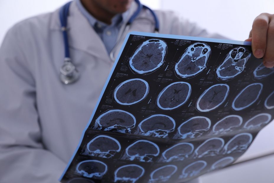 bigstock Doctor Examining Mri Images Of 466822697