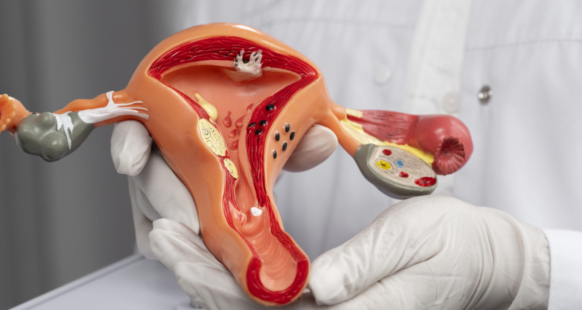 La identificación del cáncer de cérvix, un cambio en el cribado poblacional para optimizar recursos materiales y humanos