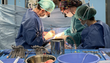 Logran el primer bypass coronario sin cirugía a corazón abierto