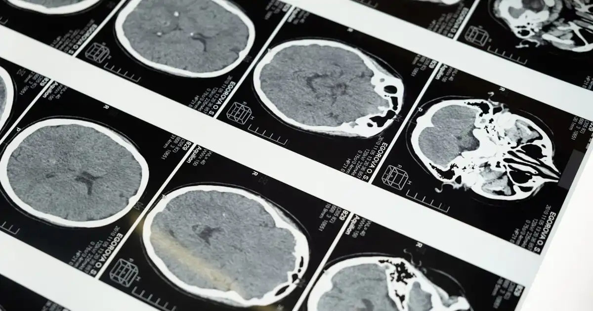 Estudian el cerebro y descubren el 'botón' que nos hace procrastinar