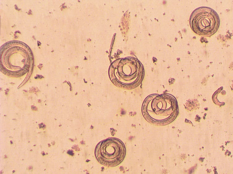 Varios ejemplares de _Trichinella spiralis_, vistos al microscopio.
